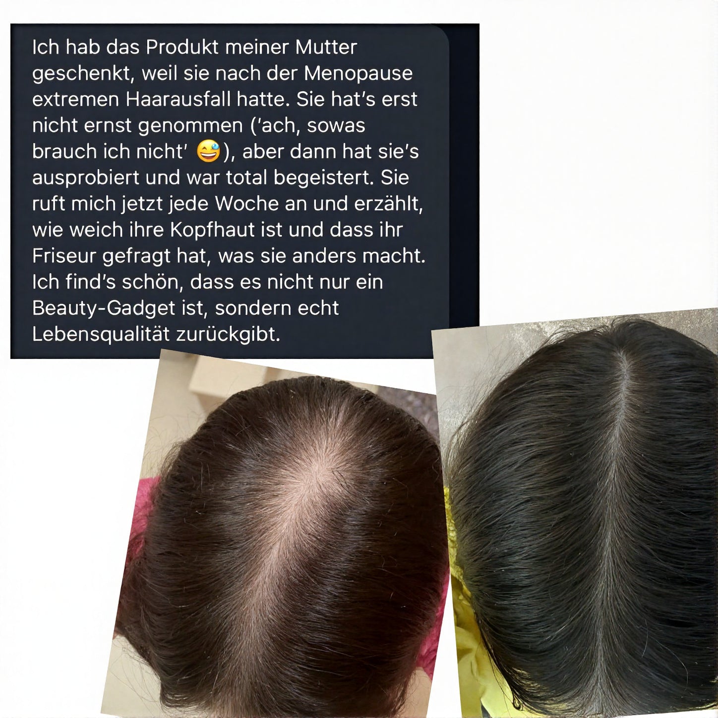 Ayesha™ Scalp Ritual Set für Hair ReGrowth