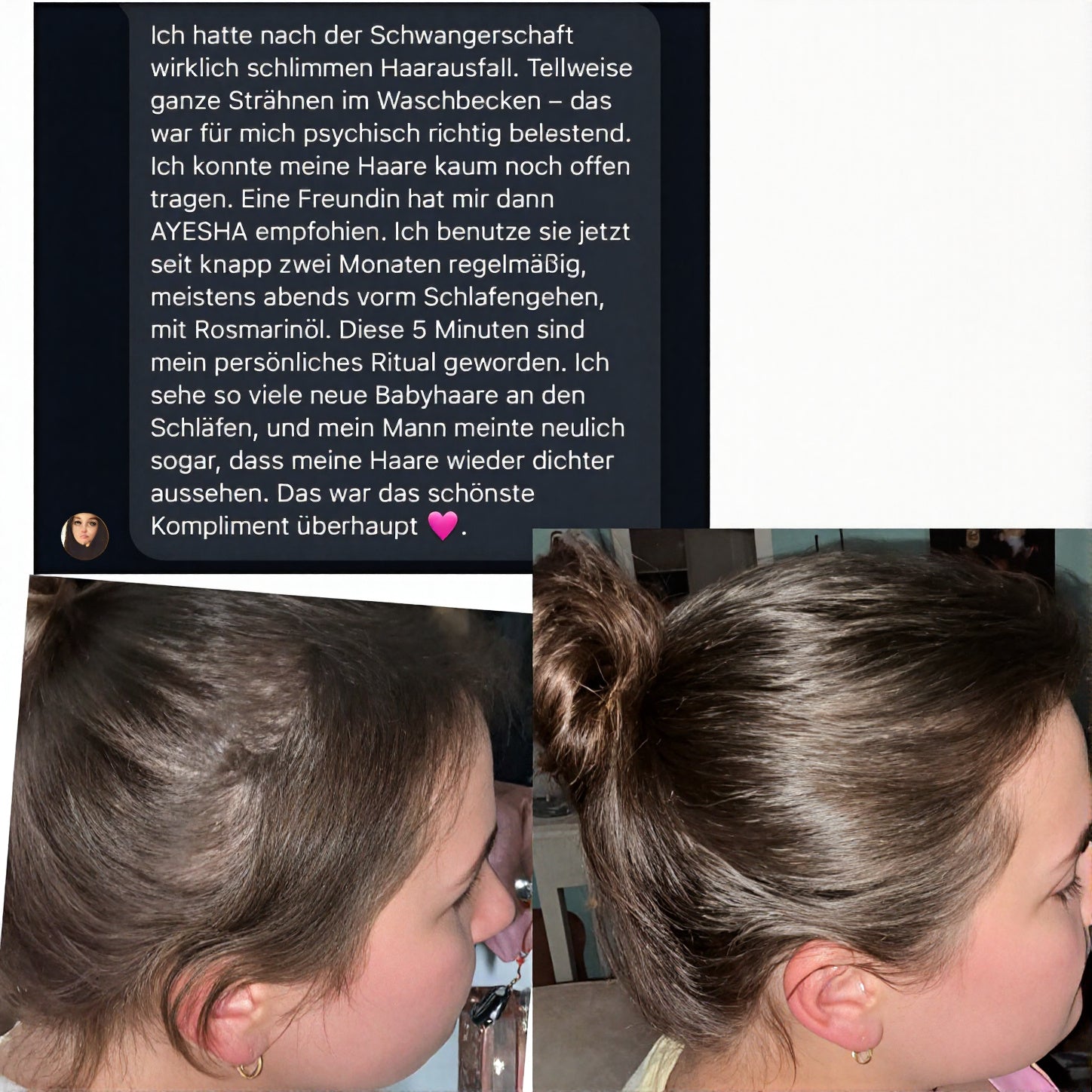 Ayesha™ Scalp Ritual Set für Hair ReGrowth