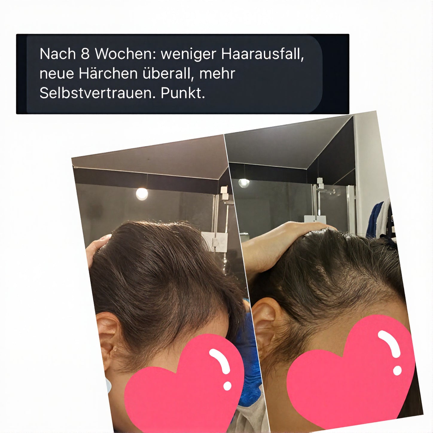 Ayesha™ Scalp Ritual Set für Hair ReGrowth