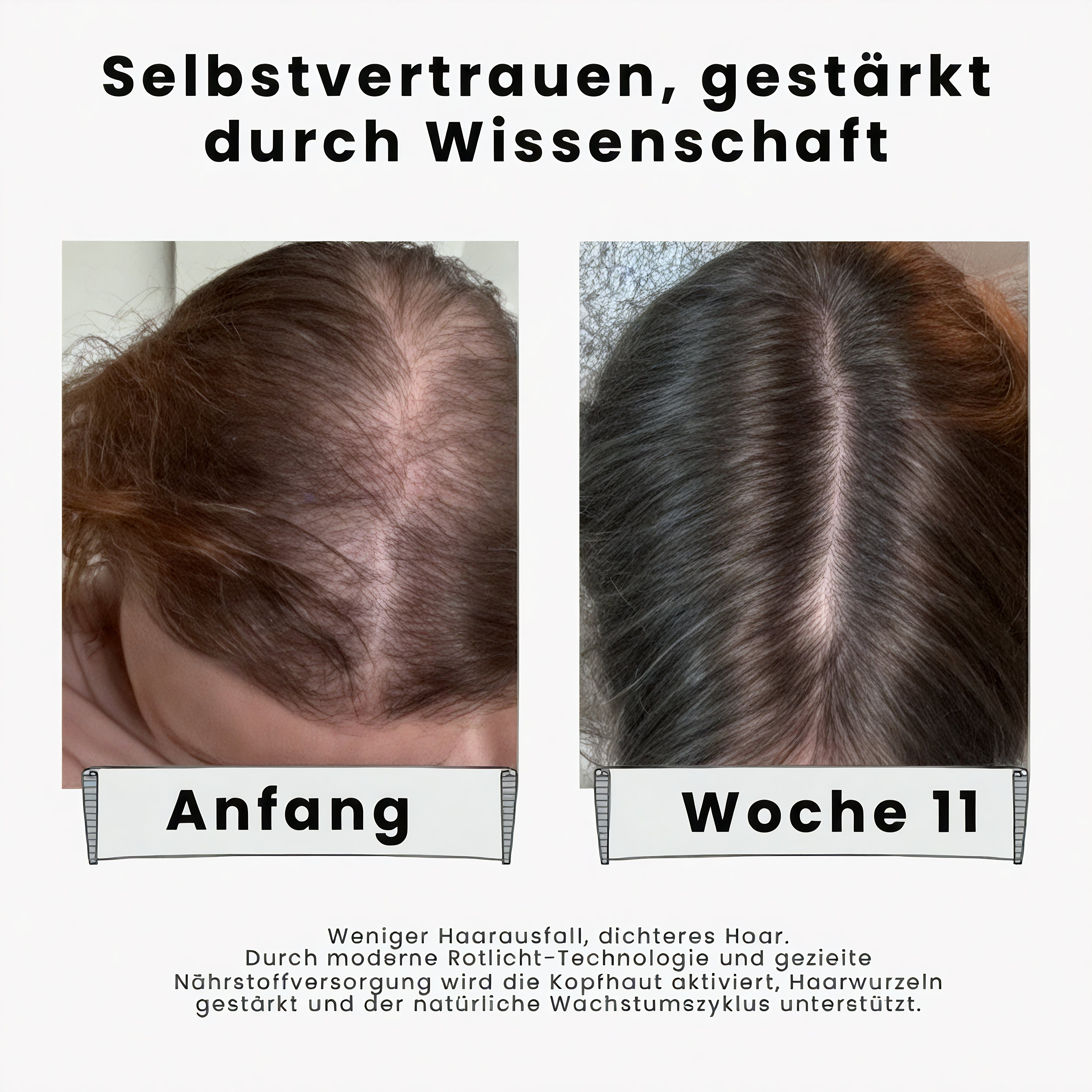 AYESHA™ Scalp Ritual Set